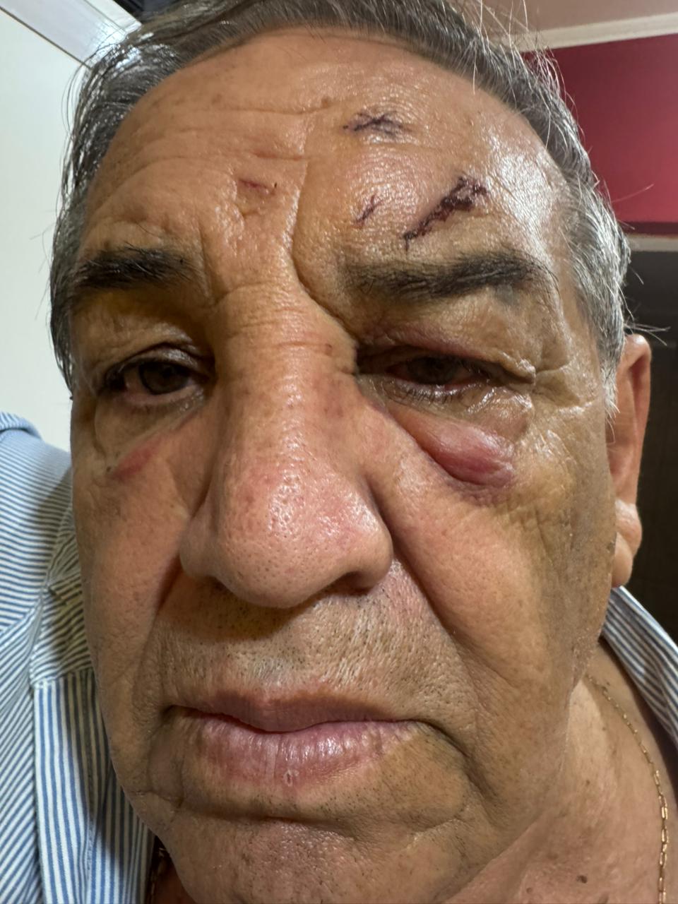 CASTELLI: DENUNCIAN BRUTAL AGRESIÓN DE DOS POLICÍAS CONTRA UN COMERCIANTE Y SU HIJO Y CRECE LA POLÉMICA POR LA VIOLENCIA INSTITUCIONAL