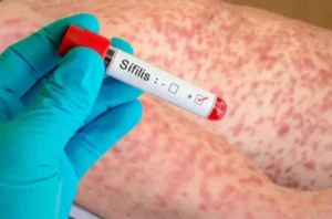 La sífilis se multiplicó por siete en Chaco: la alerta sanitaria apunta a los jóvenes